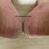crustywonkytoes from onlyfans